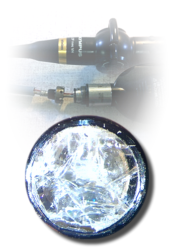 Endoscopy Services
